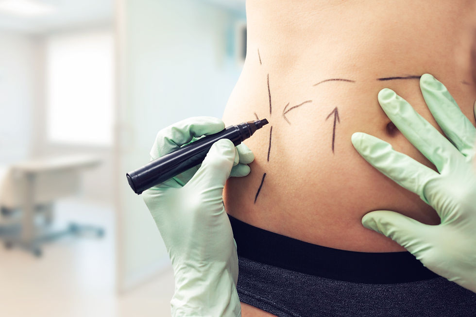 fazendo a drenagem linfática para aliviar dores e inchaços